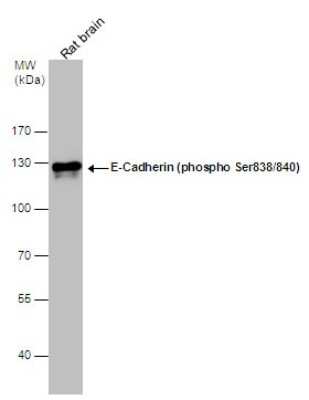Western Blot: E-Cadherin [p Ser838, p Ser840] Antibody [NBP3-12922] - E-Cadherin (phospho Ser838/840) antibody detects E-Cadherin (phospho Ser838/840) protein by western blot analysis. Rat tissue extracts (50 ug) was separated by 7.5% SDS-PAGE, and the membrane was blotted with E-Cadherin (phospho Ser838/840) antibody (NBP3-12922) diluted at 1:10000.